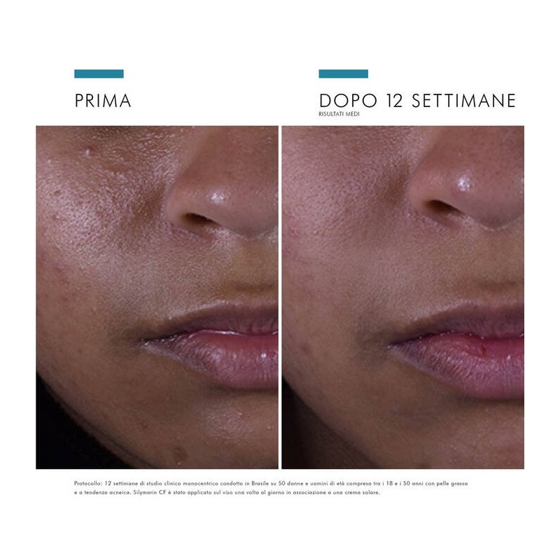 Skinceuticals Silymarin CF Siero Anti-age 30ML