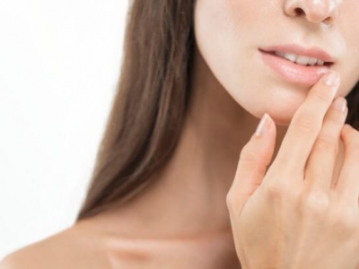 Labbra screpolate: i 5 consigli di Alpifarma per prevenire